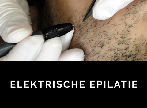 ELEKTRISCHE EPILATIE